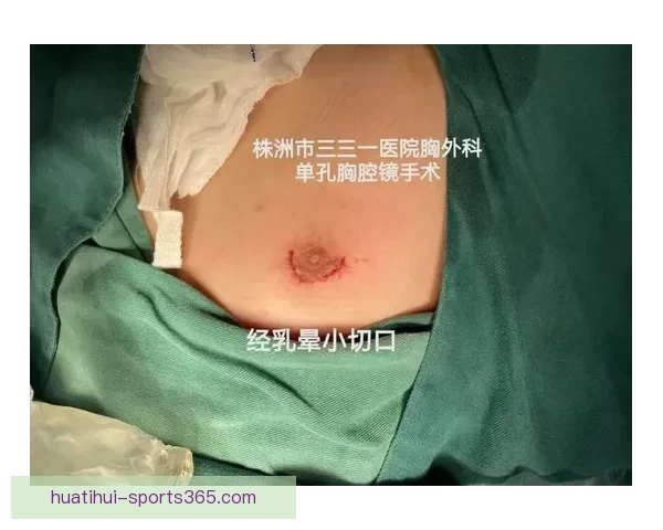 坎宁安气胸康复持续推进 活塞计划一周后复查评估 坎宁安气胸康复持续推进 活塞计划一周后复查评估